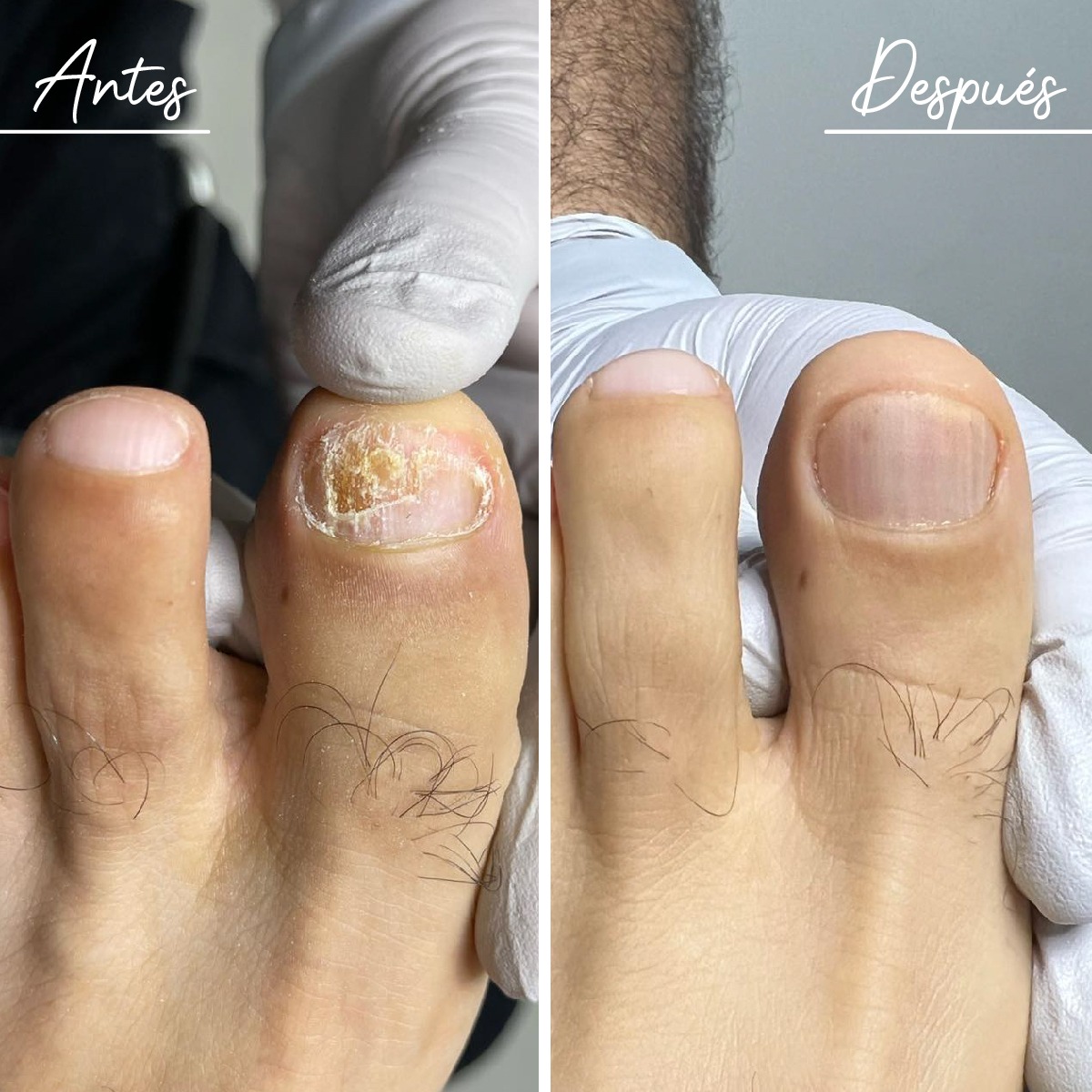 Casa Podológica Tijuana Facebook ad: Adiós al hongo en las uñas