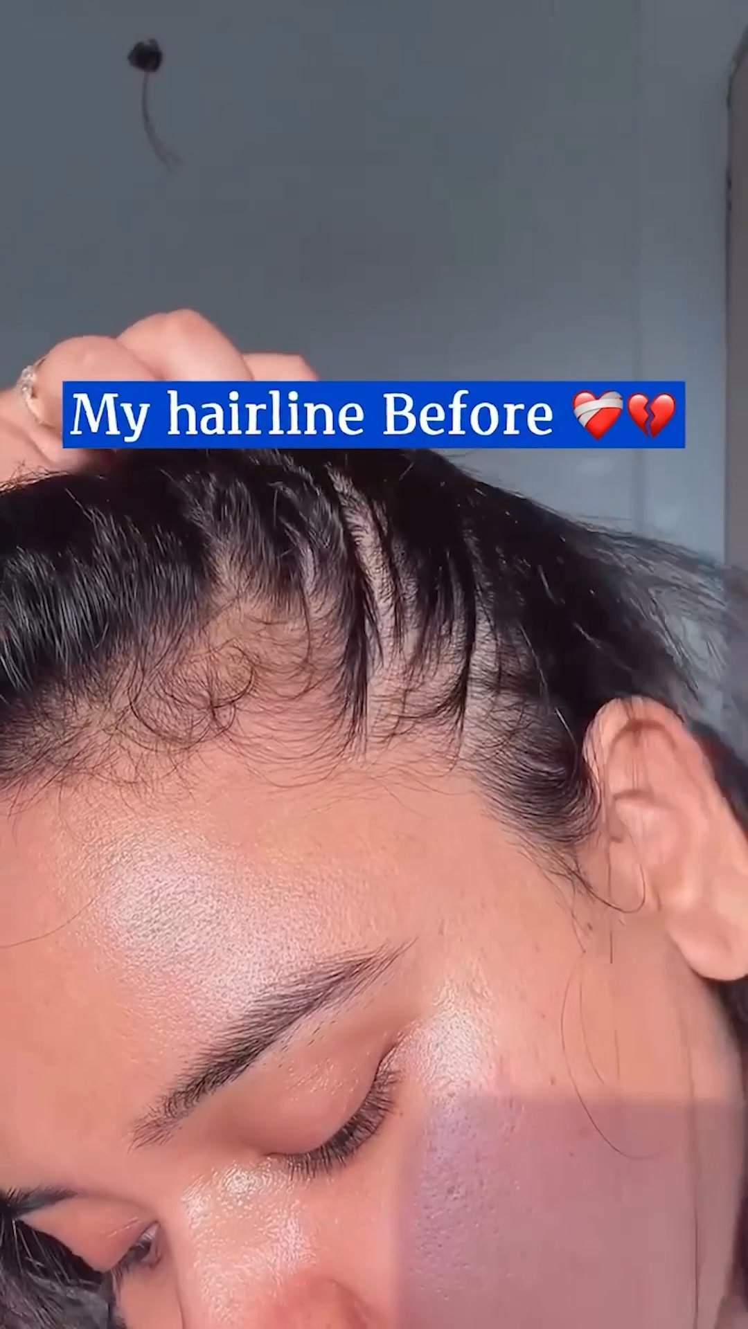 Skincare with dr.sreya Facebook ad: Get faster hair growth!