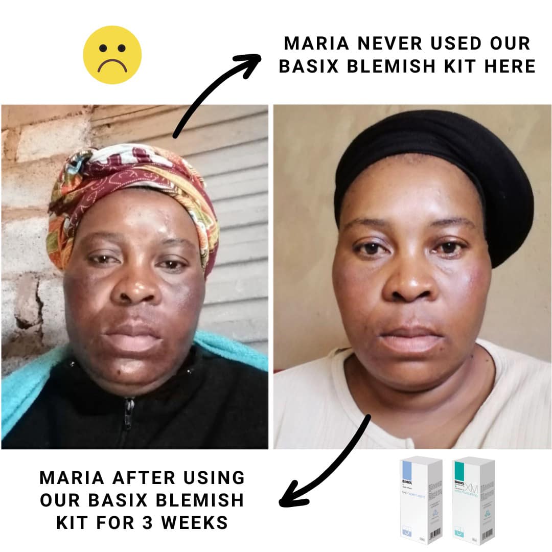 Basix Skin Care Facebook ad: ASK US how to FIX your skin today…