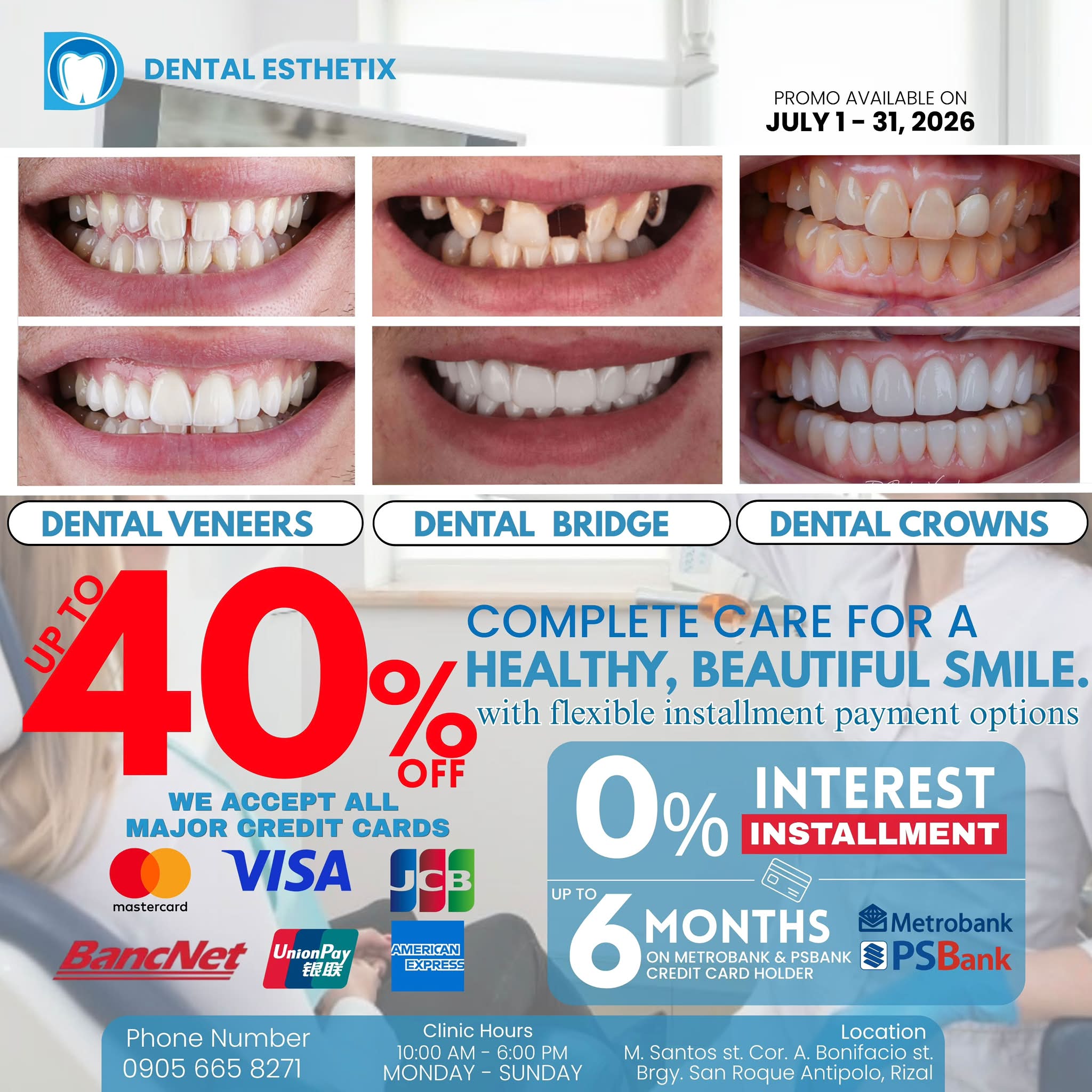 Dental Esthetix - Antipolo Facebook ad: THE BIGGEST SMILE TRANSFORMATION OFFER THIS JULY ONLY!