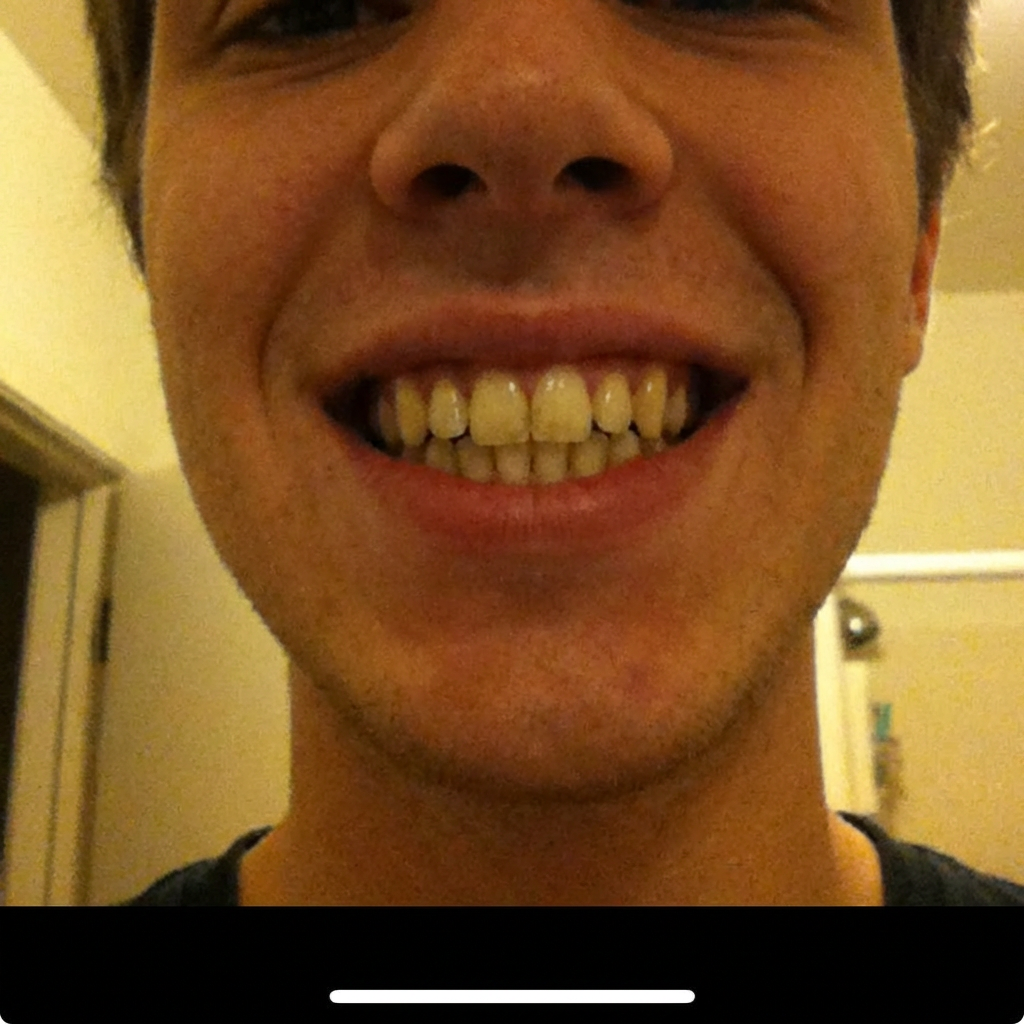 Chris Hill Facebook ad: Read this if you have yellow teeth