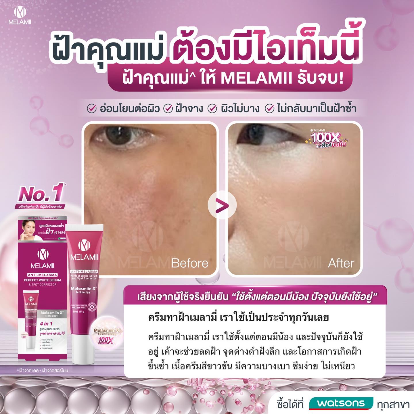 Melamii Anti Melasma Club Facebook ad
