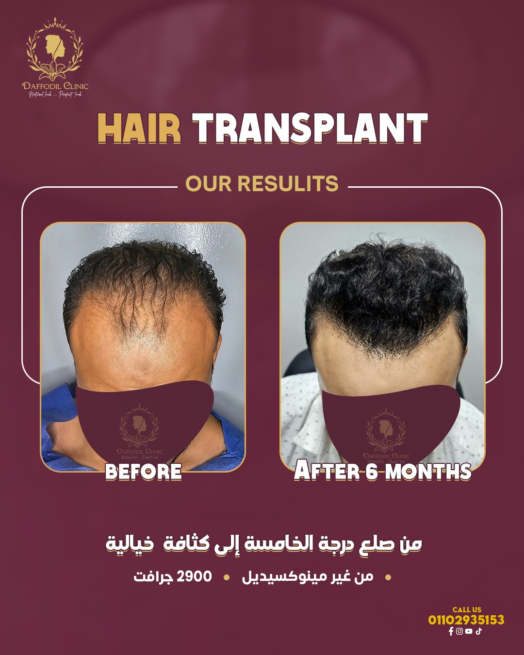 Daffodil Clinic Facebook ad: لما الكل يقول مستحيل، إحنا بنقول:أهلاً بالتحدي
