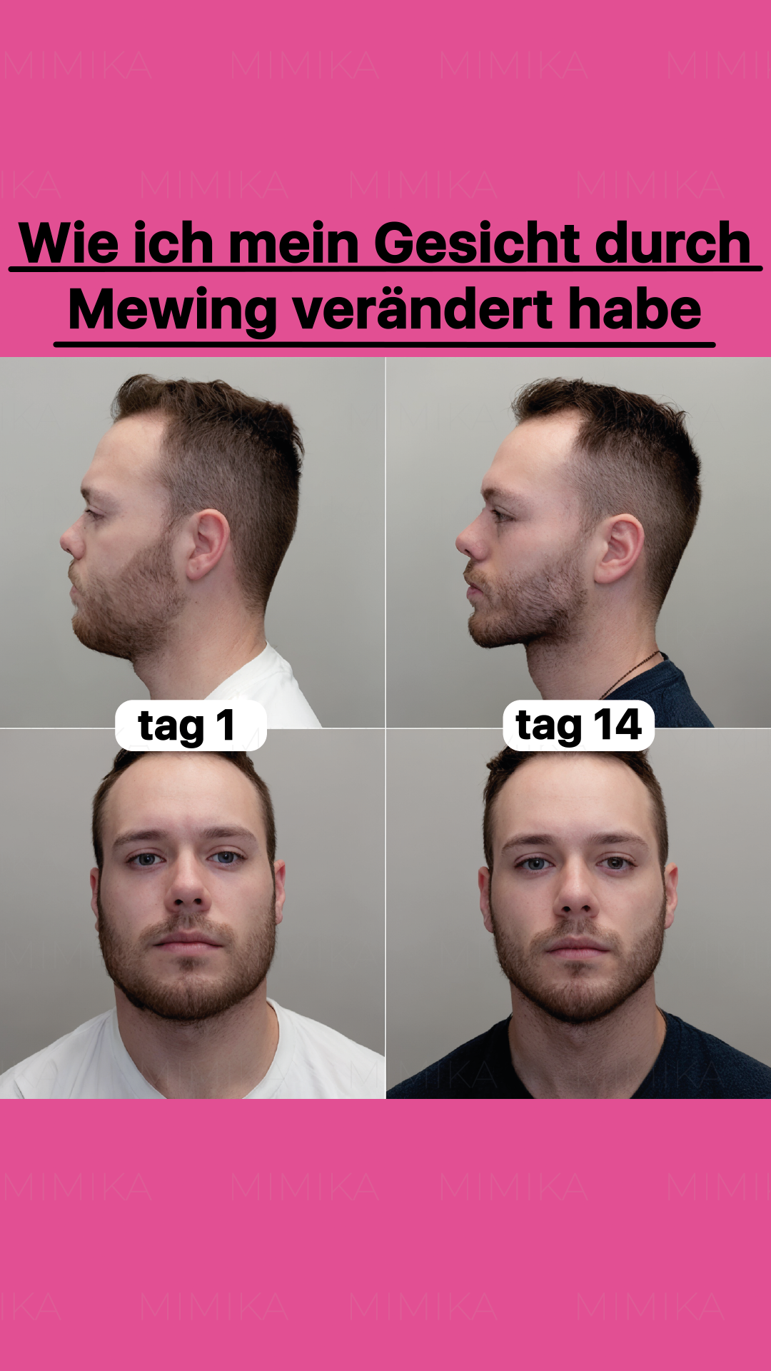Mark Mewing Facebook ad
