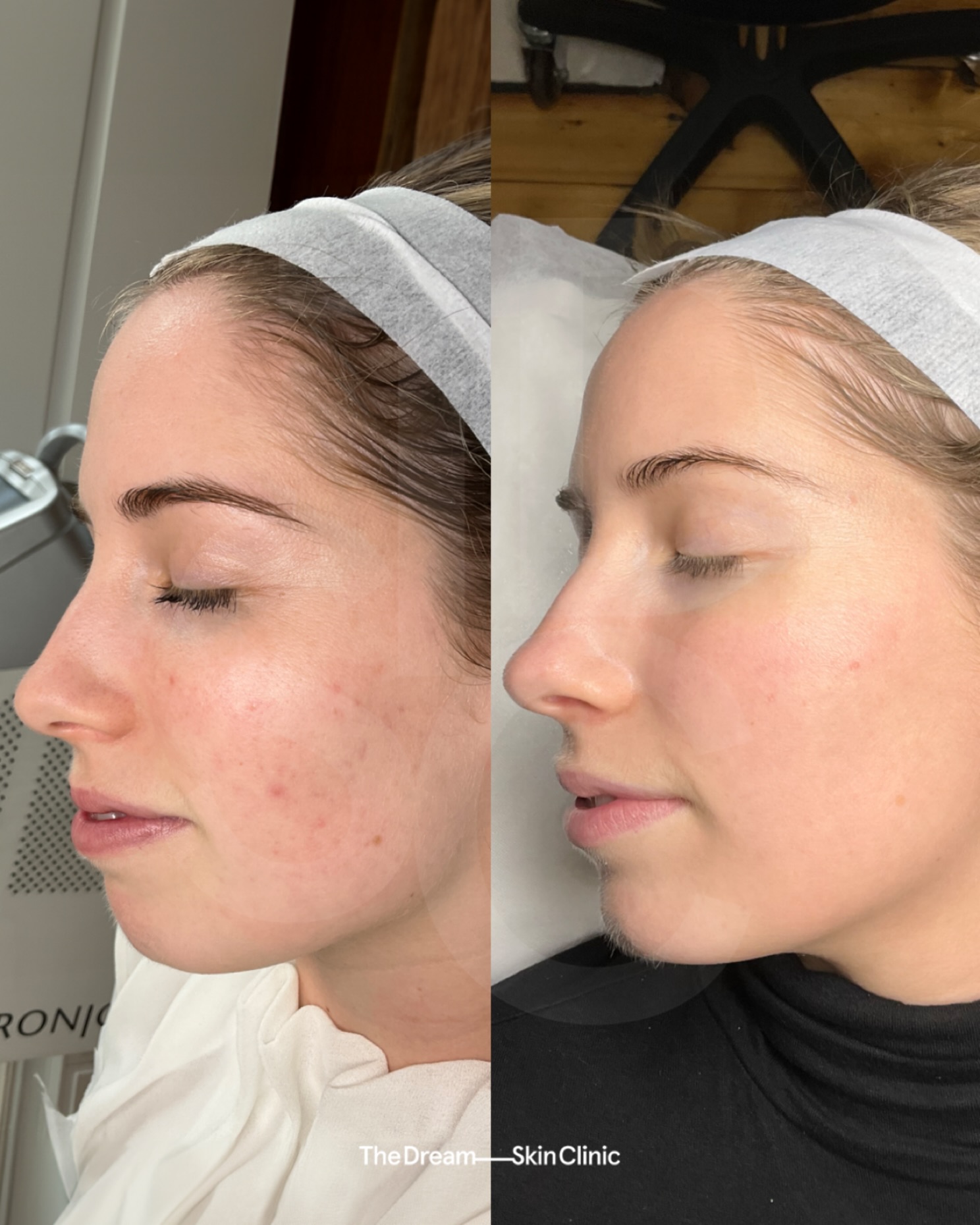 The Dream Skin Clinic Facebook ad: Reputation for Results