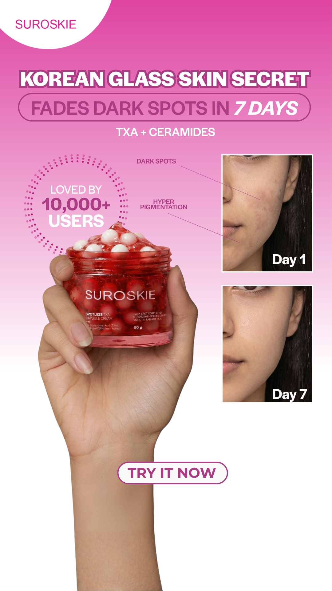 Suroskie Facebook ad