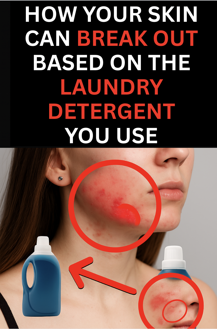 Eco-Friendly Living Daily Facebook ad: Random breakouts? Ditch your laundry detergent