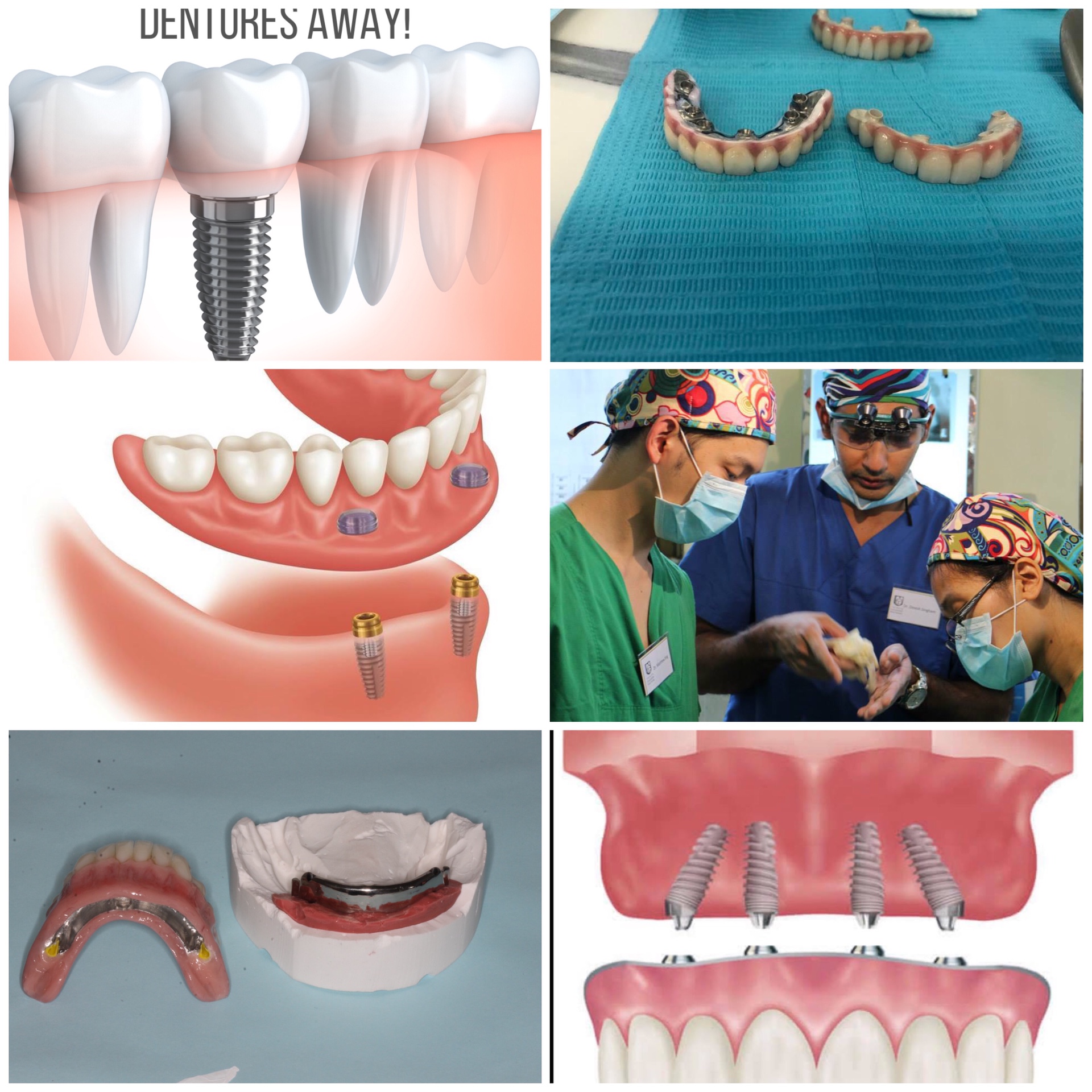 Absolutely Dental Facebook ad: Confused about the different Dental implant options?