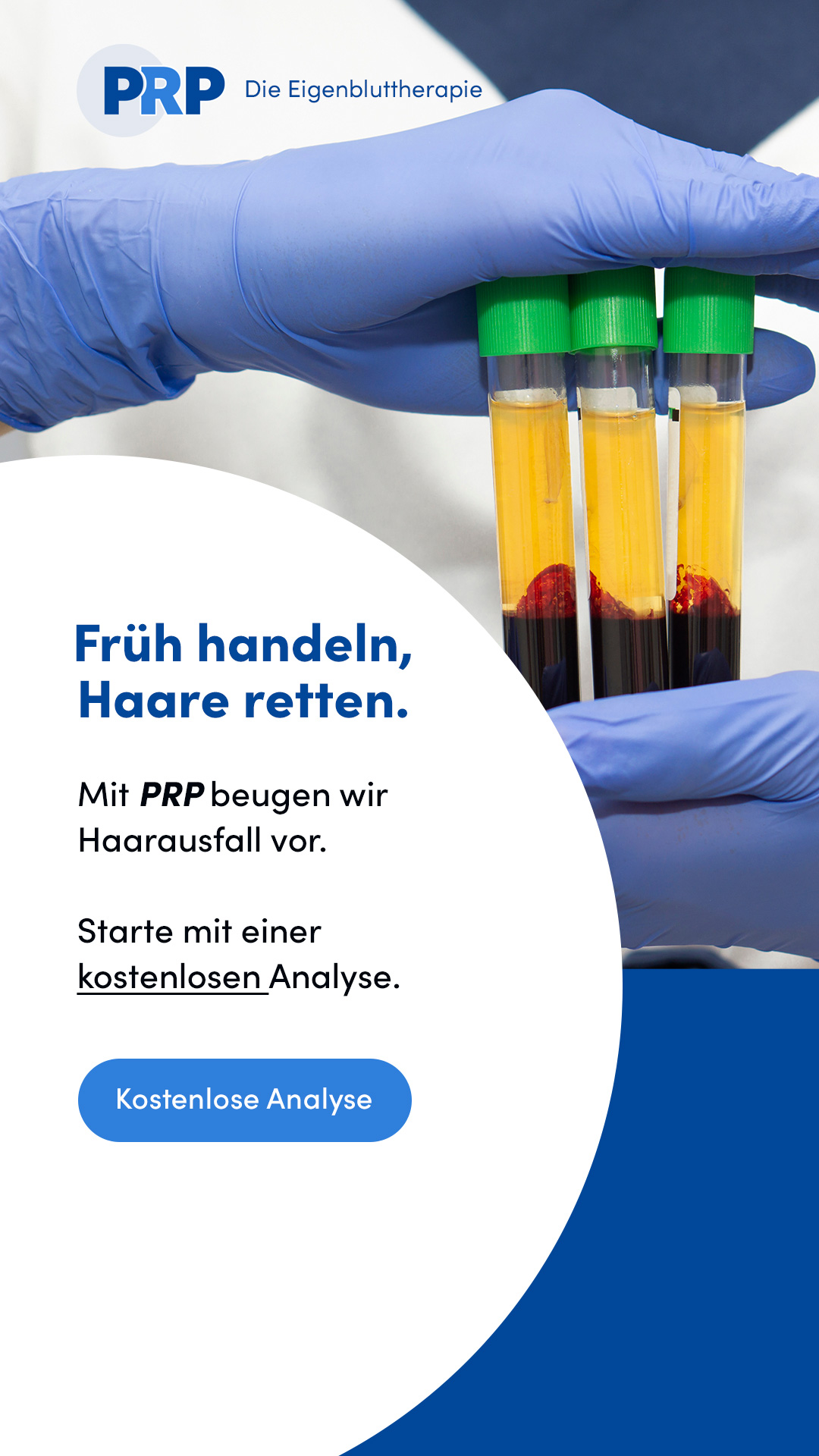 PRP Behandlung Facebook ad