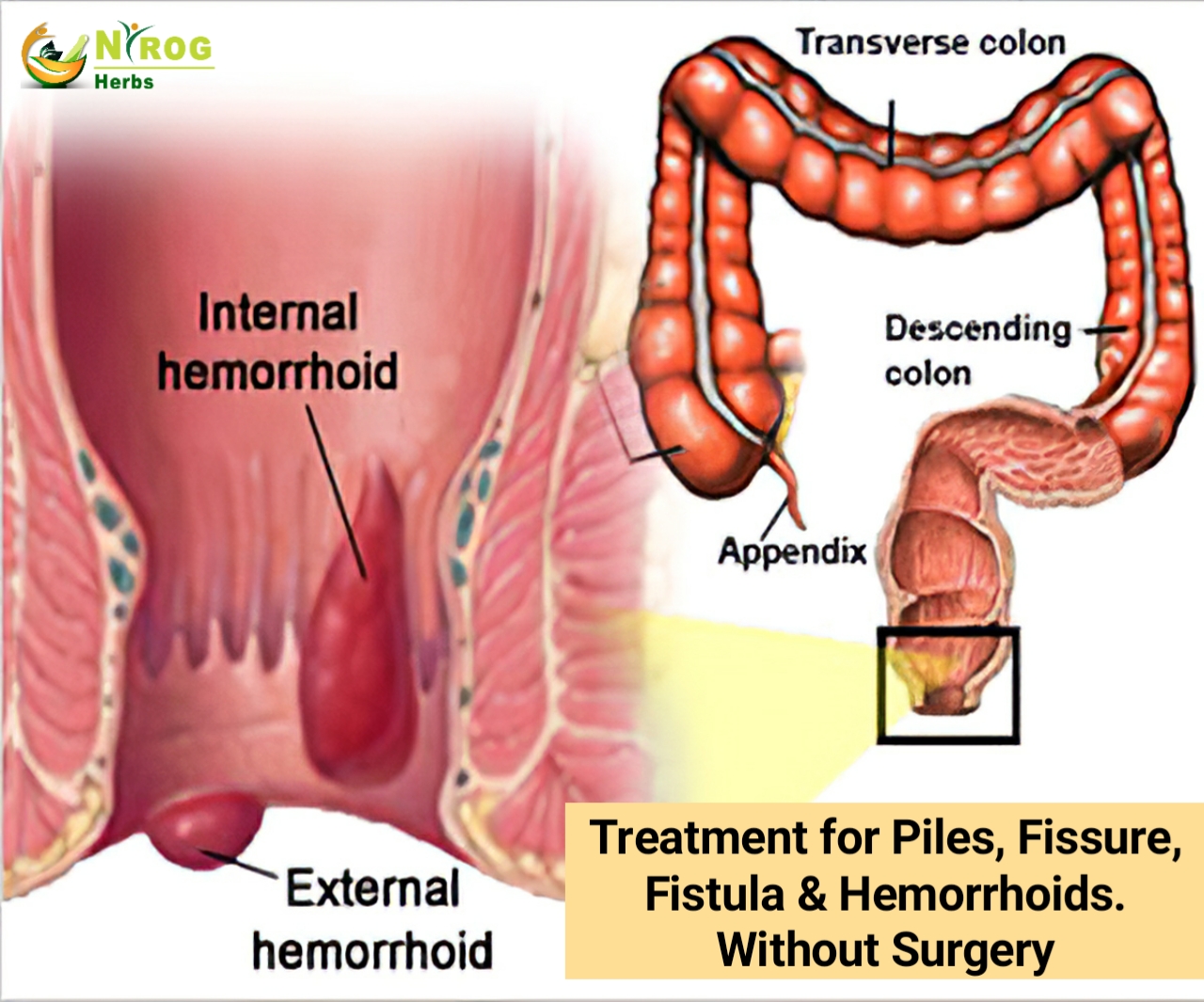 Nirog Herbs Health Pvt. Ltd. Facebook ad