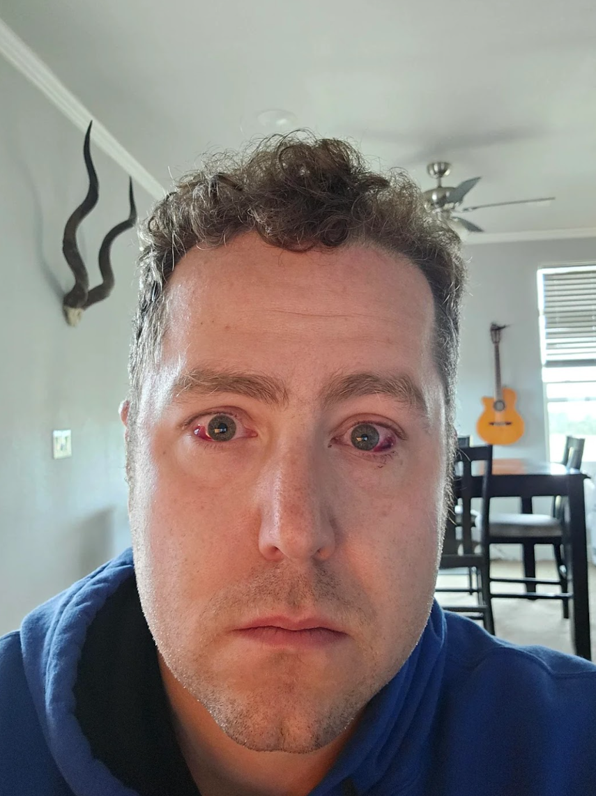Dr. Michael Brennan Facebook ad