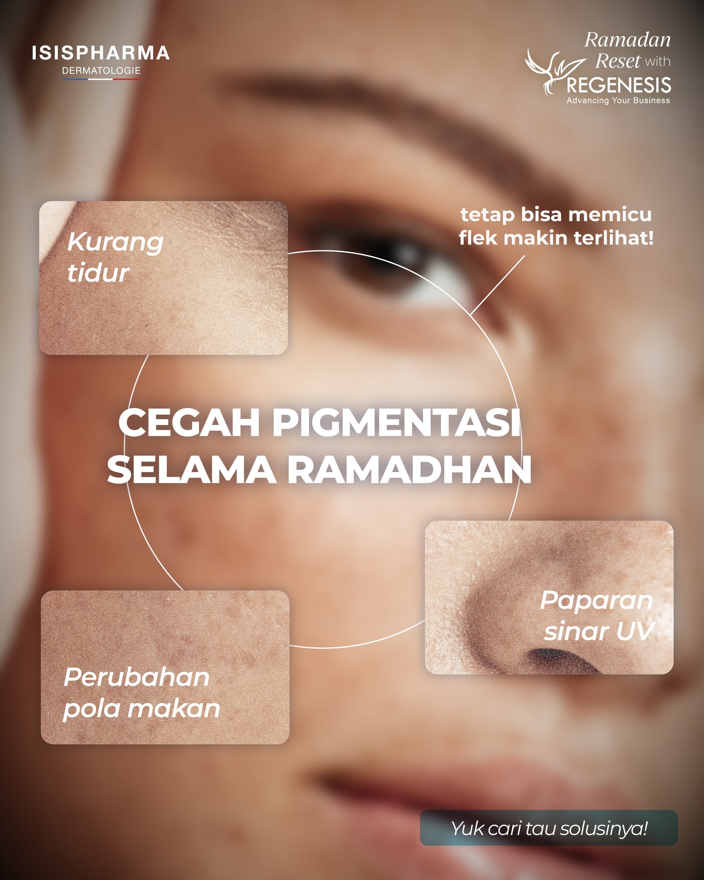 Isispharma Indonesia Facebook ad: Cegah pigmentasi selama ramadhan agar kulit tetap cerah…
