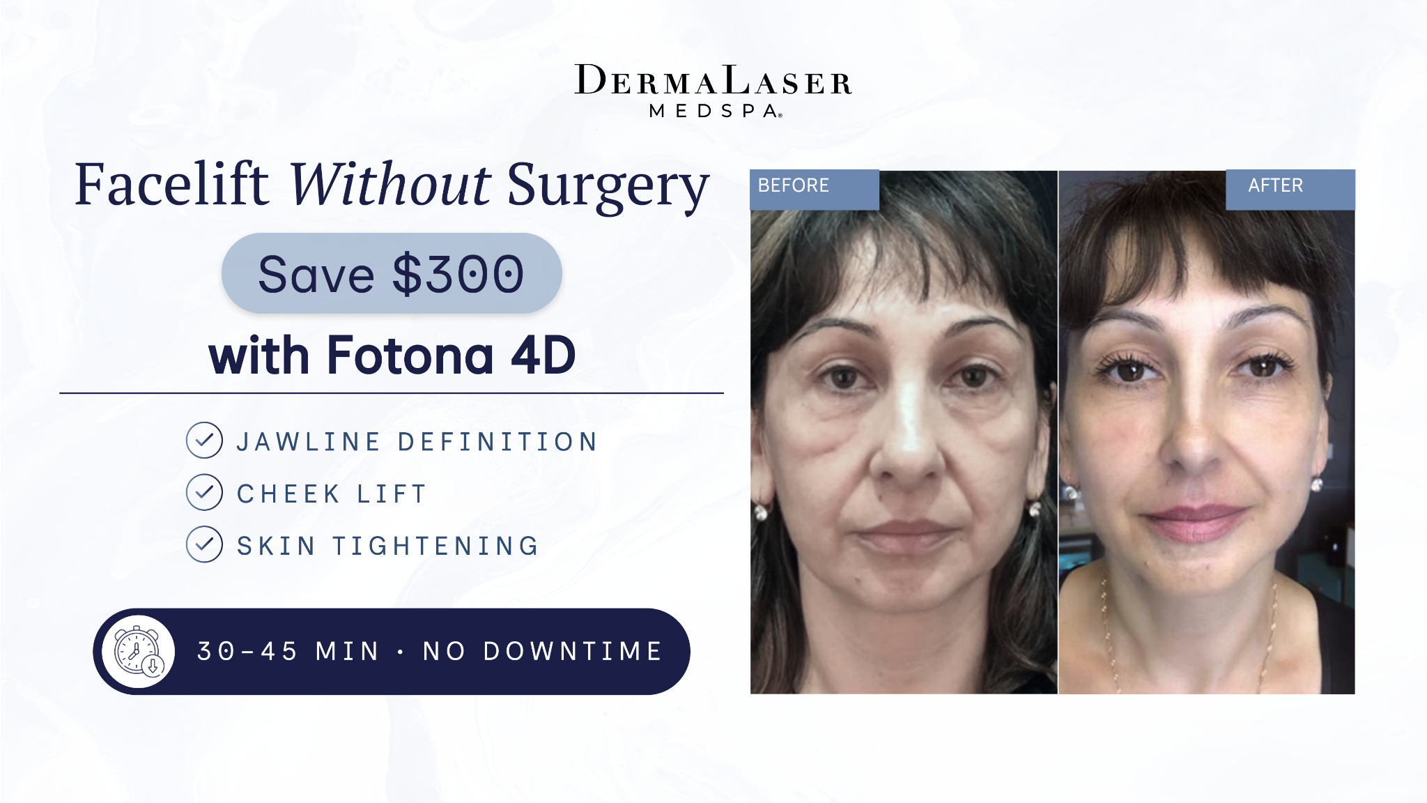 DermaLaser Medspa Facebook ad from Dec 5, 2025