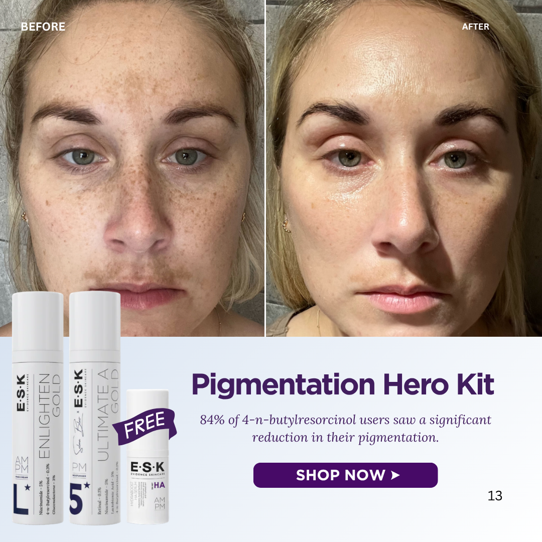 ESK  Evidence Skincare Facebook ad