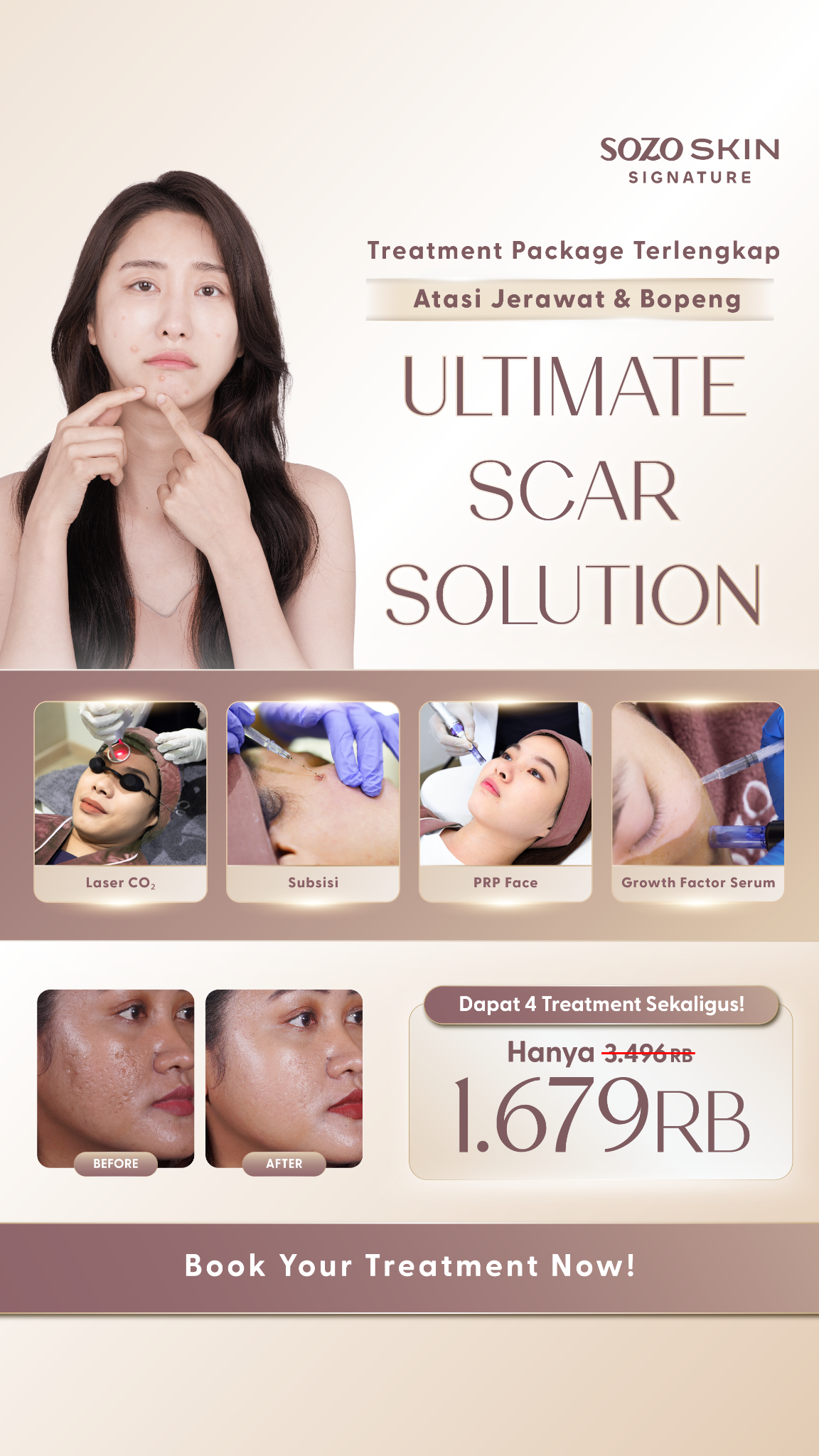 Sozo Signature Facebook ad