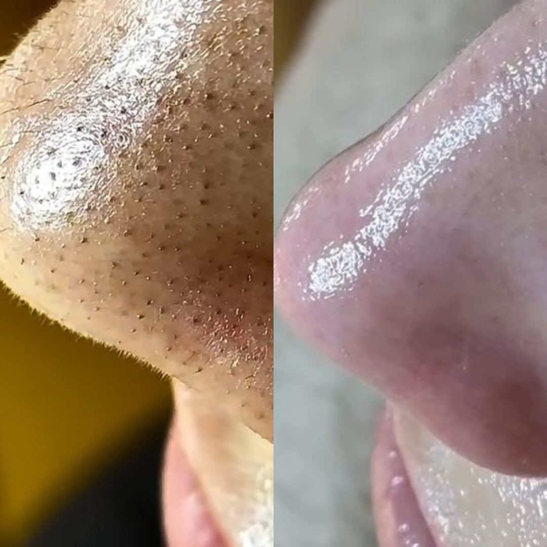AG Spa - Beauty Salon Facebook ad: Clear Up Your Skin