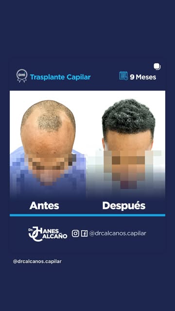 Dr. Jhanes Calcaño Facebook ad
