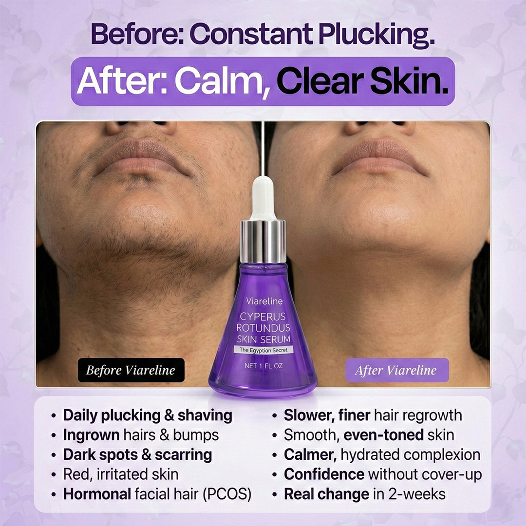 Syvara Facebook ad: Tired of the PCOS 'Chin-Shadow'? Thin it out naturally.