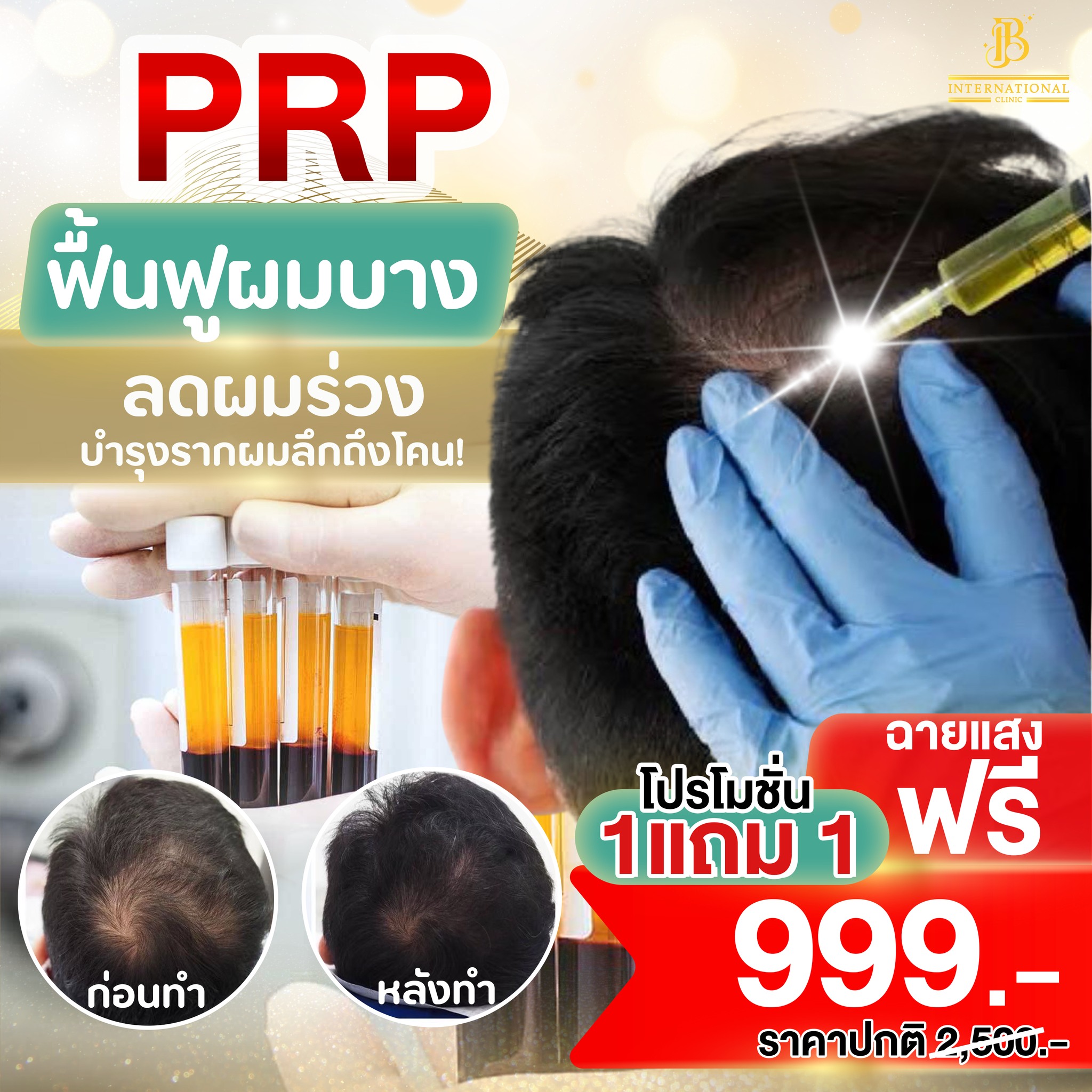 บีเจ อินเตอร์เน่ชานแนล คลินิก BJ international Clinic สาขาสกลนคร Facebook ad