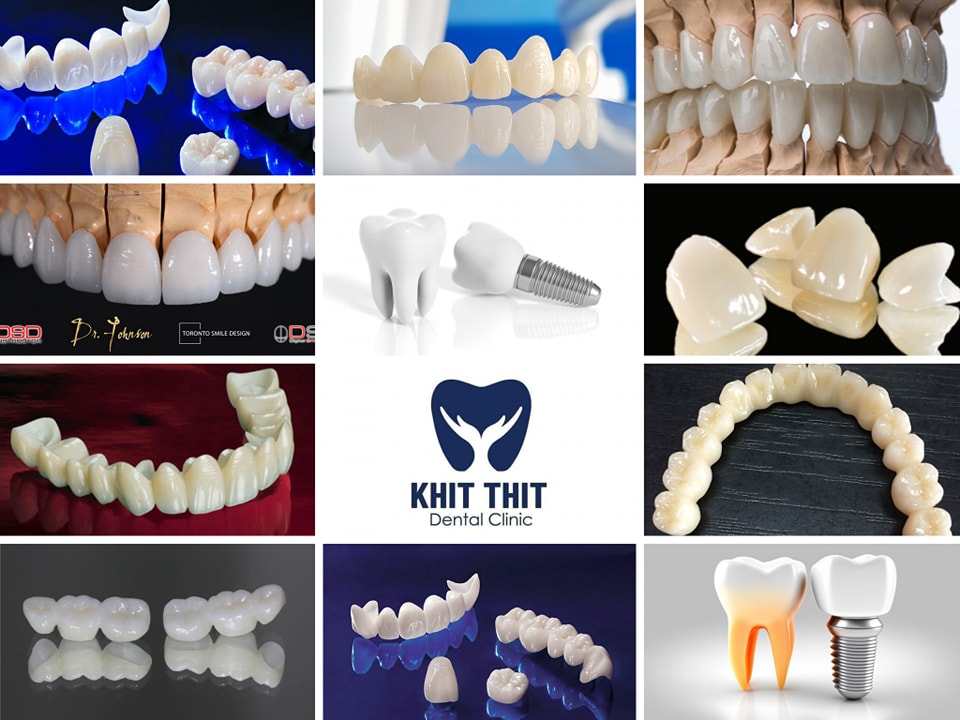 Khit Thit Dental Clinic Facebook ad: လူတန်းစားမရွေး သင့်တင့်လျောက်ပတ်သော စျေးနှုန်းဖြင့်…