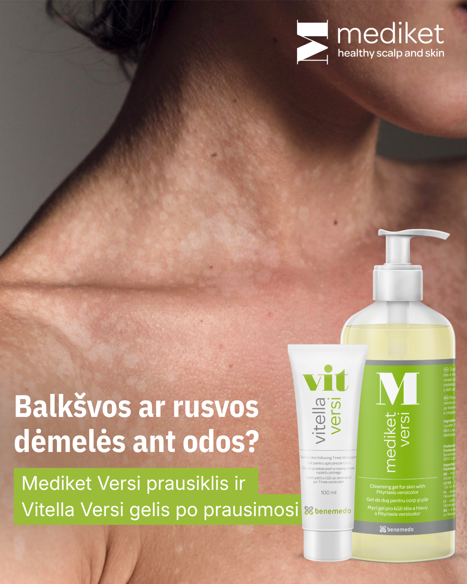 Vitella & Mediket Lietuva Facebook ad: Pasirūpinkite savo oda