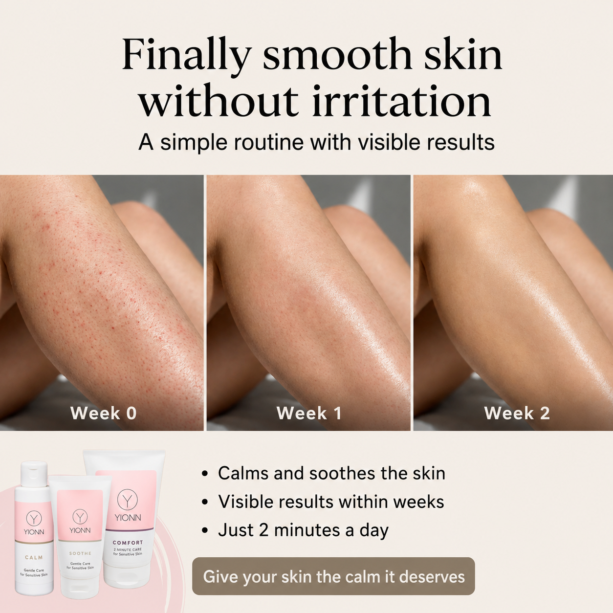 YIONN Facebook ad: What if it isn't your sensitive skin?