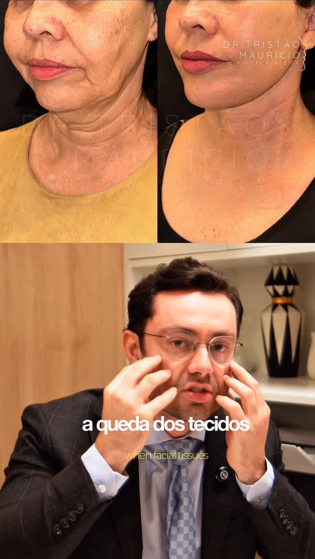 Dr. Tristao Mauricio Facebook ad: ATENÇÃO: Todo tecido vivo tem um limite de…