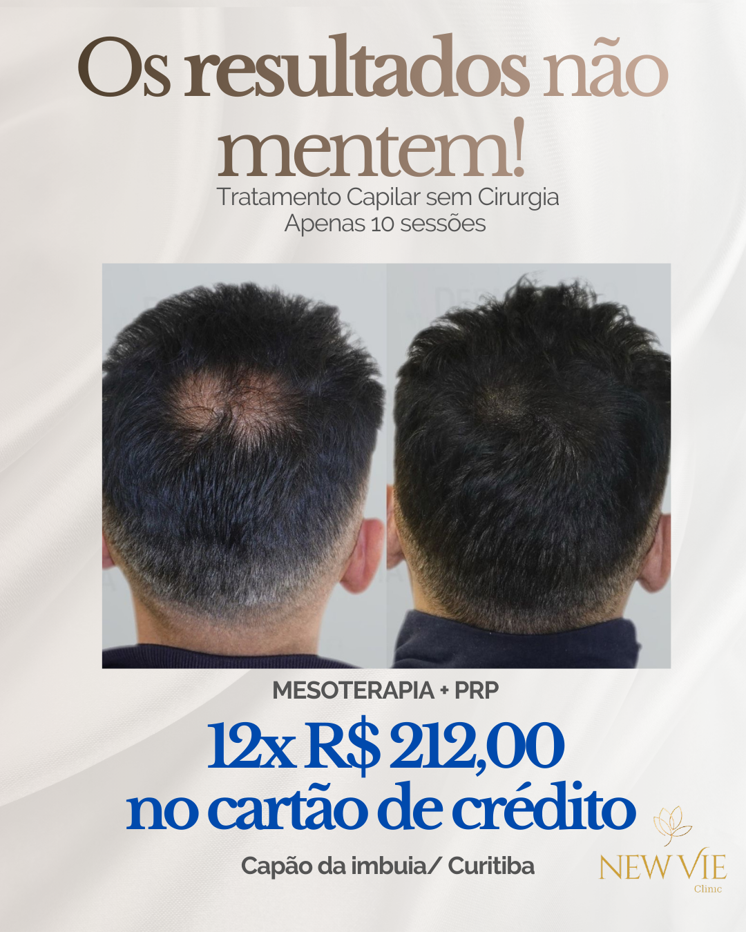 NewVie Clinic Facebook ad