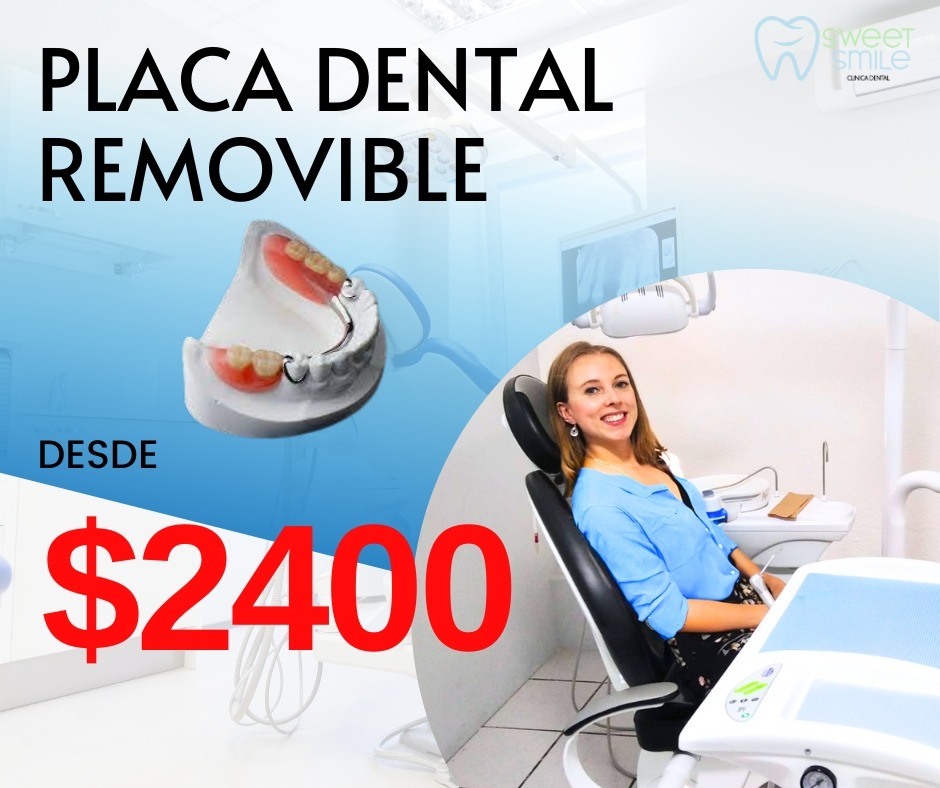 Sweet Smile - Clínica dental Facebook ad: Dentista