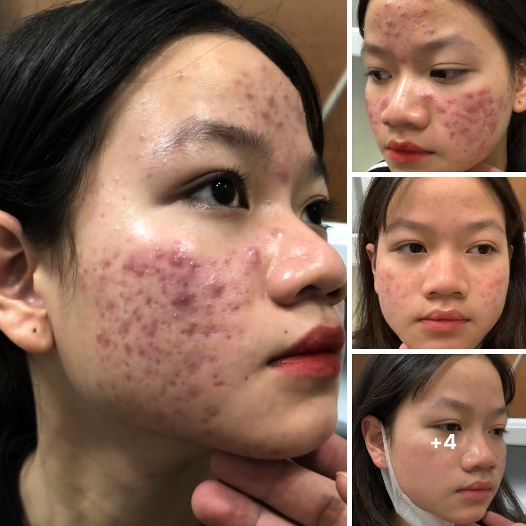 JBeauty Skin Center Facebook ad: All in just 1 treatment package!