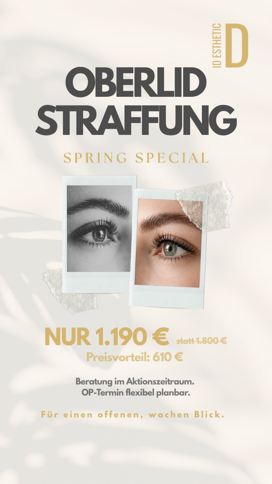 ID Esthetic Facebook ad