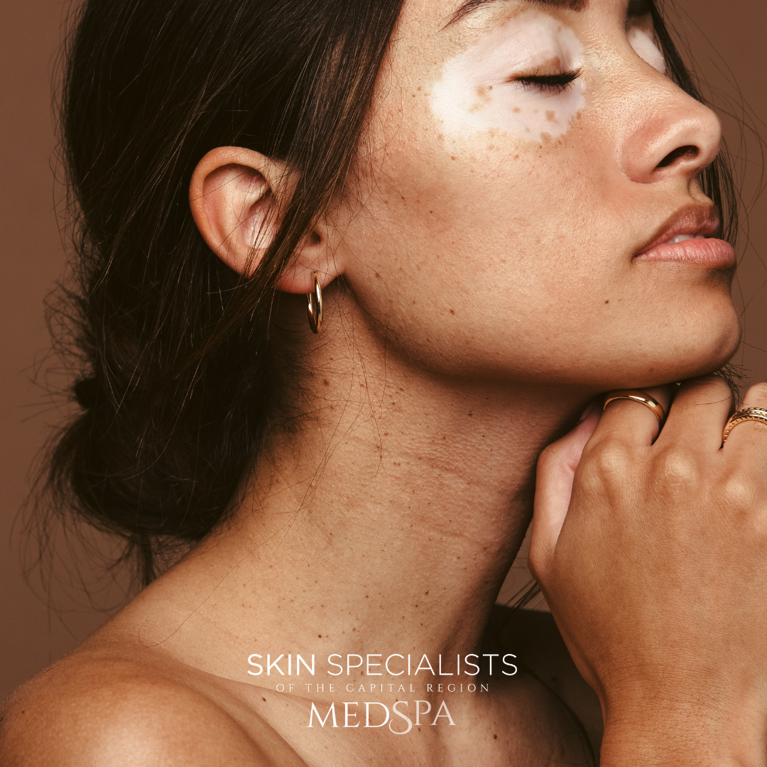 SKIN Specialists of the Capital Region Facebook ad