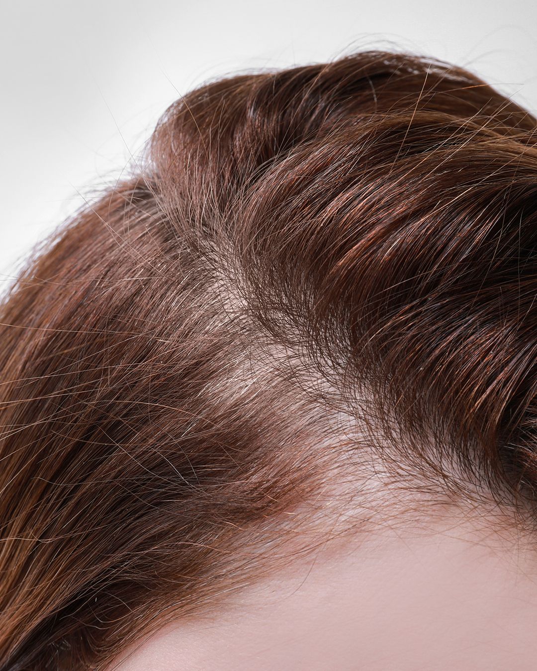 Skinmed AG Facebook ad: Dünner werdendes Haar oder vermehrter Haarausfall?