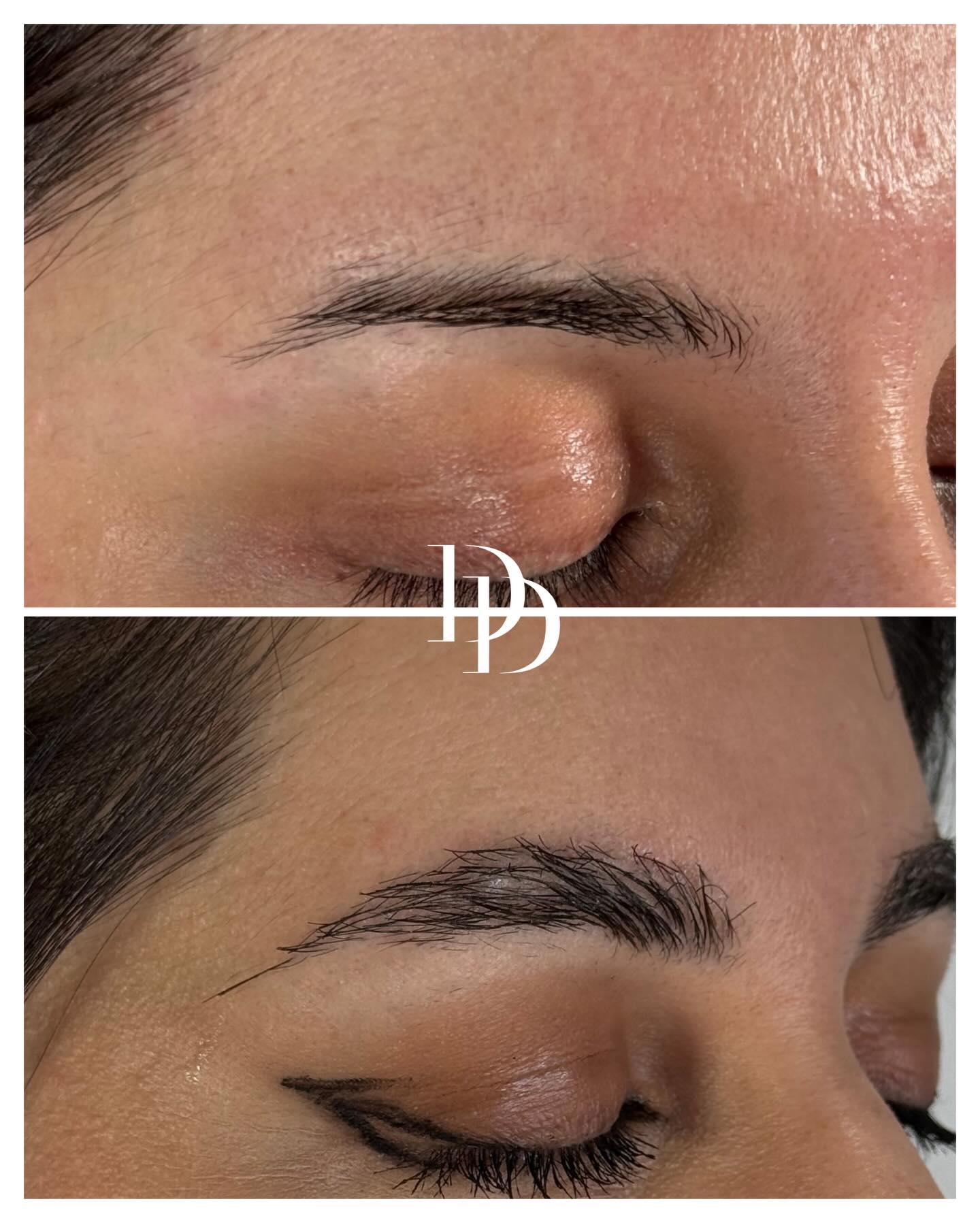 Dr. Ducu Facebook ad: Say goodbye to thinning brows!