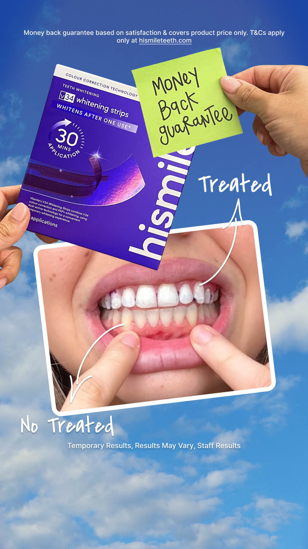 Hismile Facebook ad