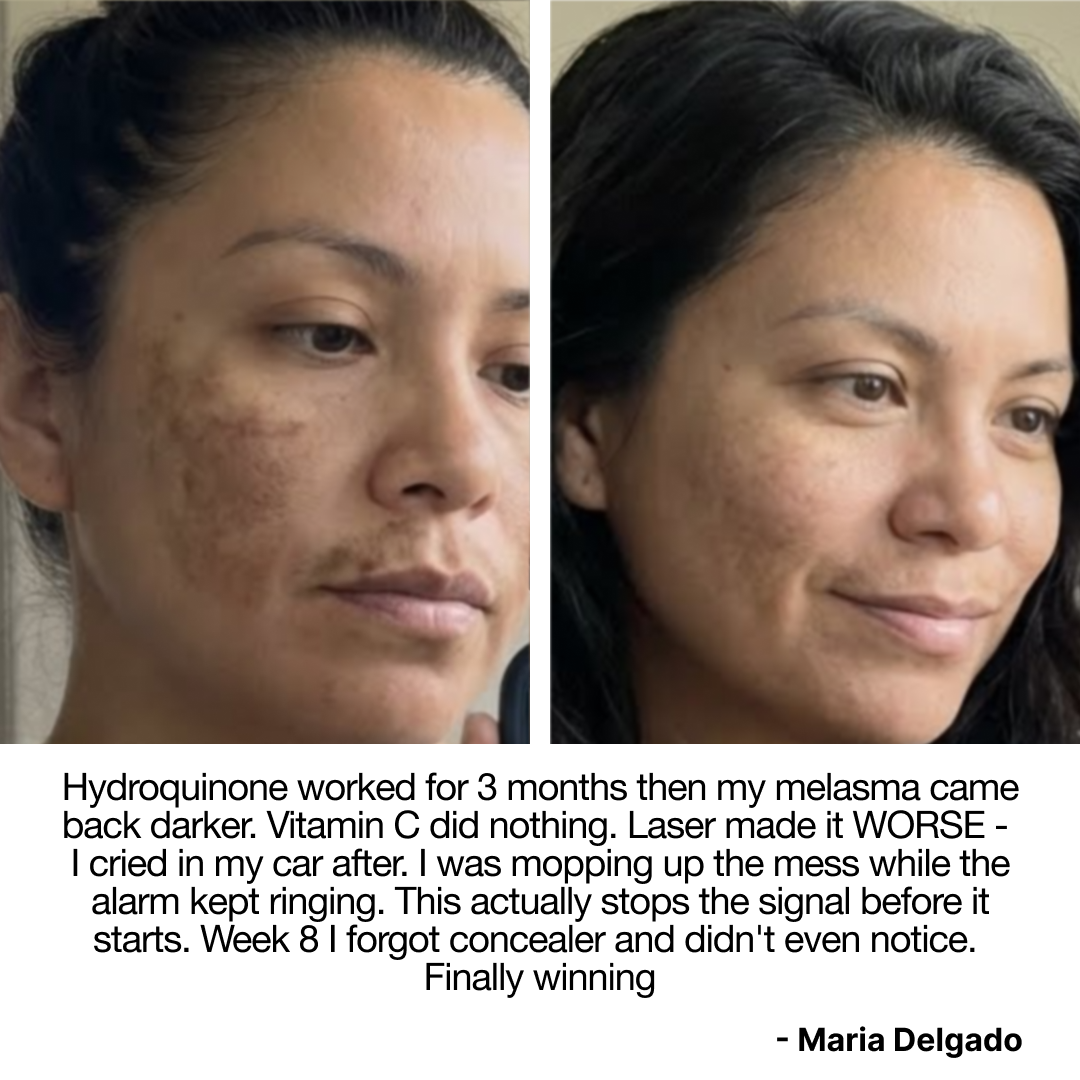 OMIC+ Skincare Facebook ad: If you suffer from melasma read this