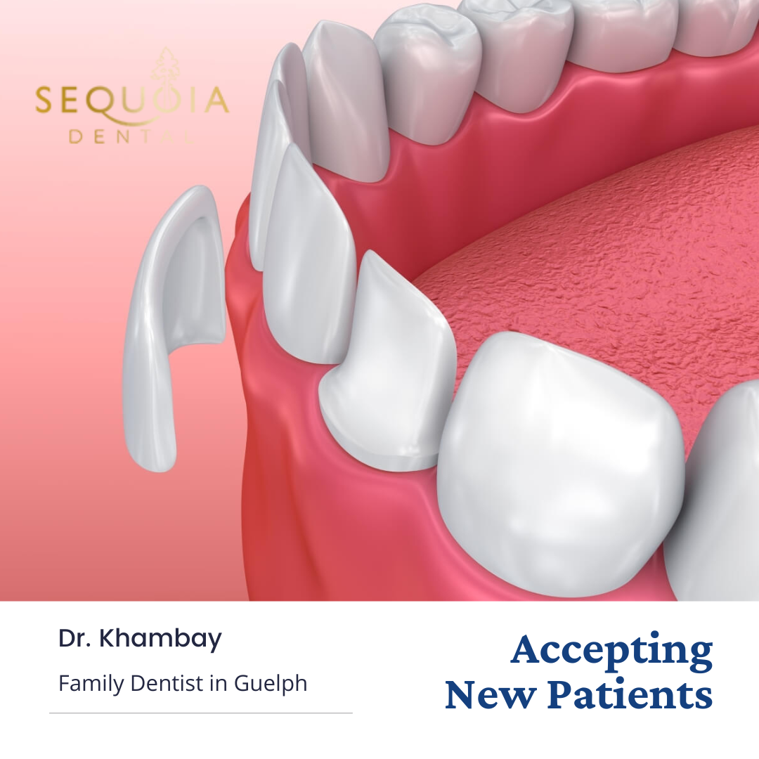 Sequoia Dental Facebook ad: SEQUOIA DENTAL GUELPH