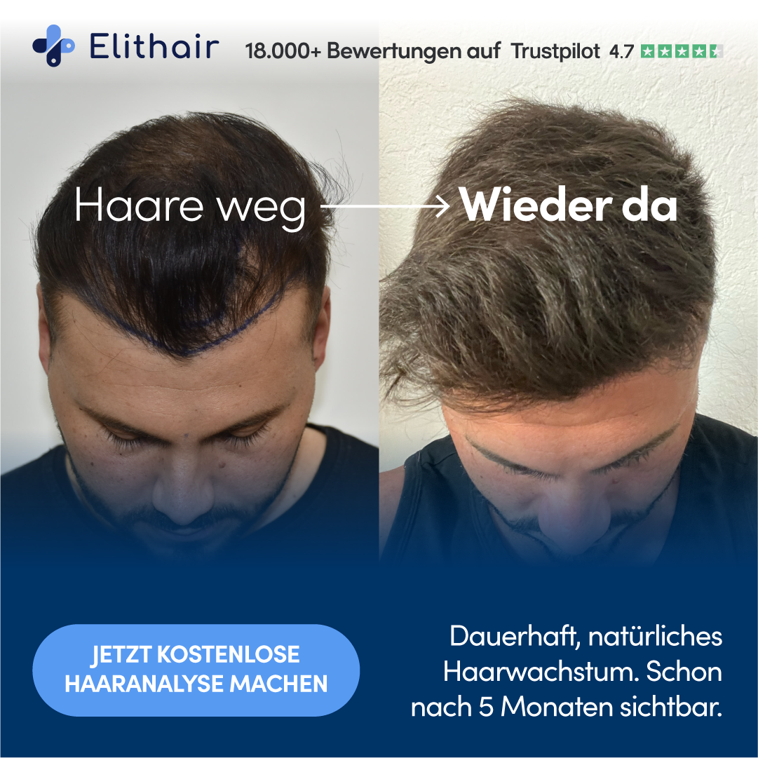 Elithair Facebook ad: Jetzt kostenlose Haaranalyse