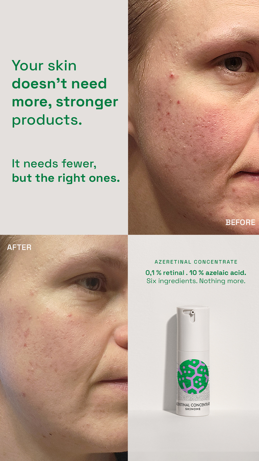 Skinome Facebook ad