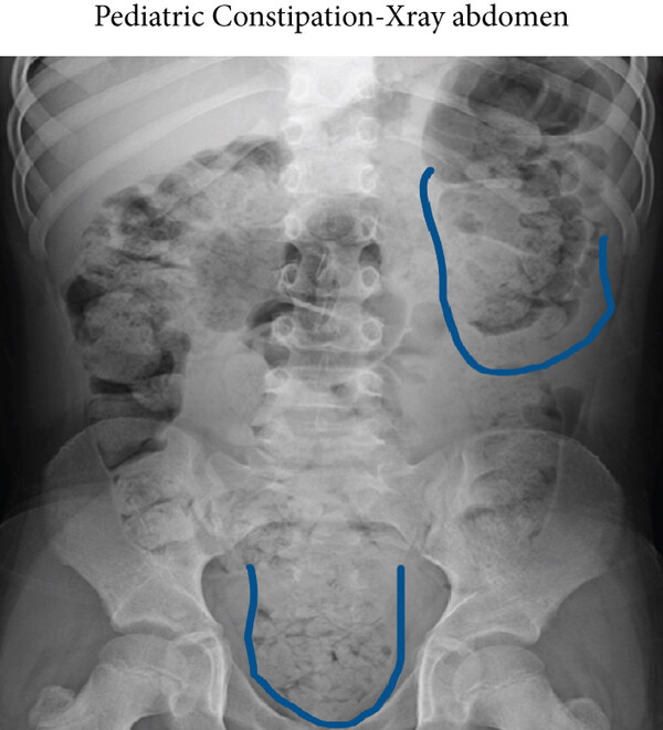 Dr. Amanda Wilson - Gastroenterologist Facebook ad: Kiss Goodbye to 10 lb of Poop Stuck Inside You
