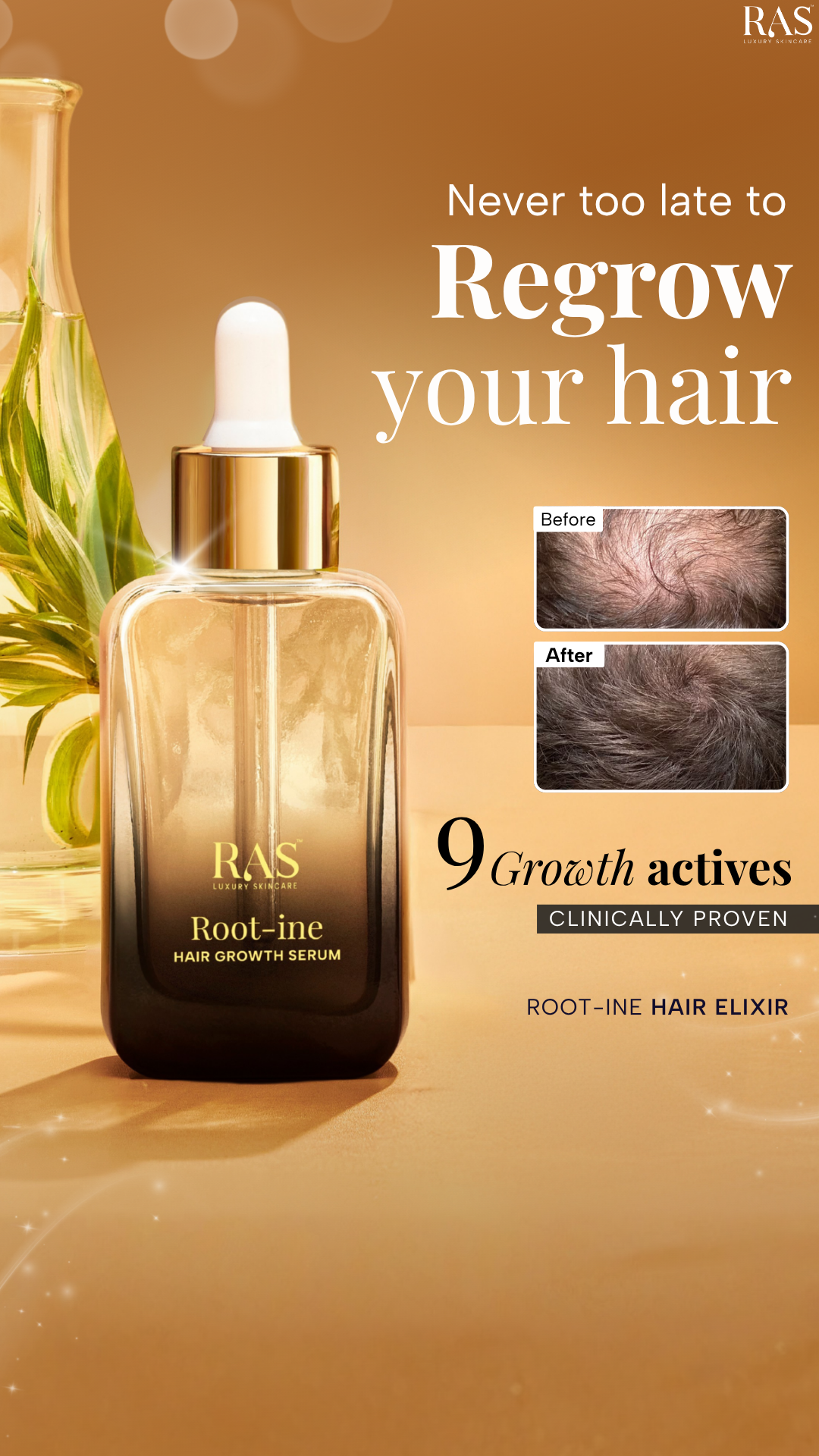 RAS Luxury Oils Facebook ad: RAS Root-ine Hair Growth Serum with 19.5% Scalp Actives