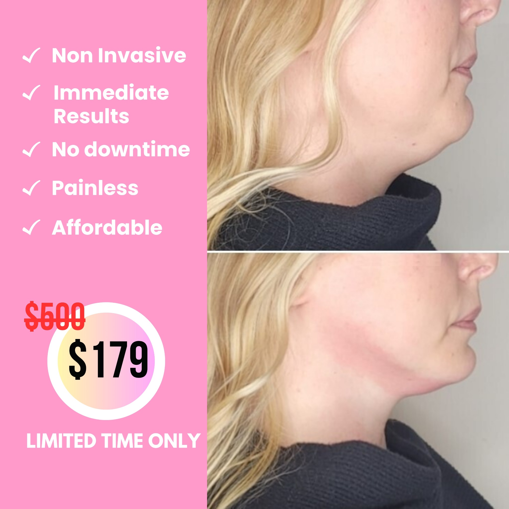 US Cryotherapy - Roseville, CA Facebook ad: ONLY $179 (SAVE 65%) Limited Time Only