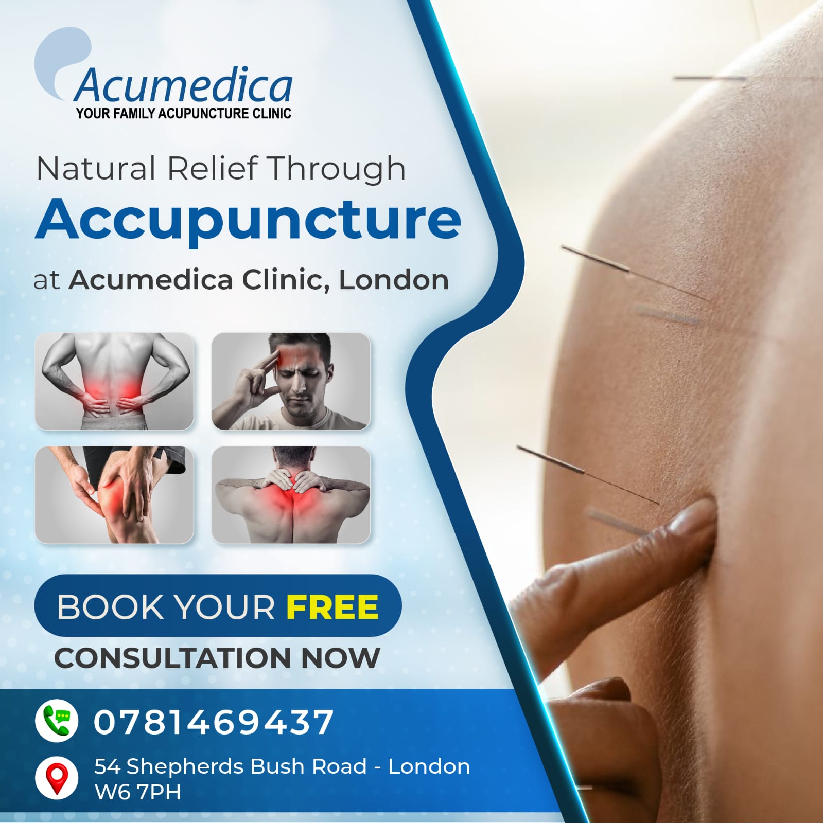Acumedica Facebook ad: Feel Better Naturally with Acupuncture