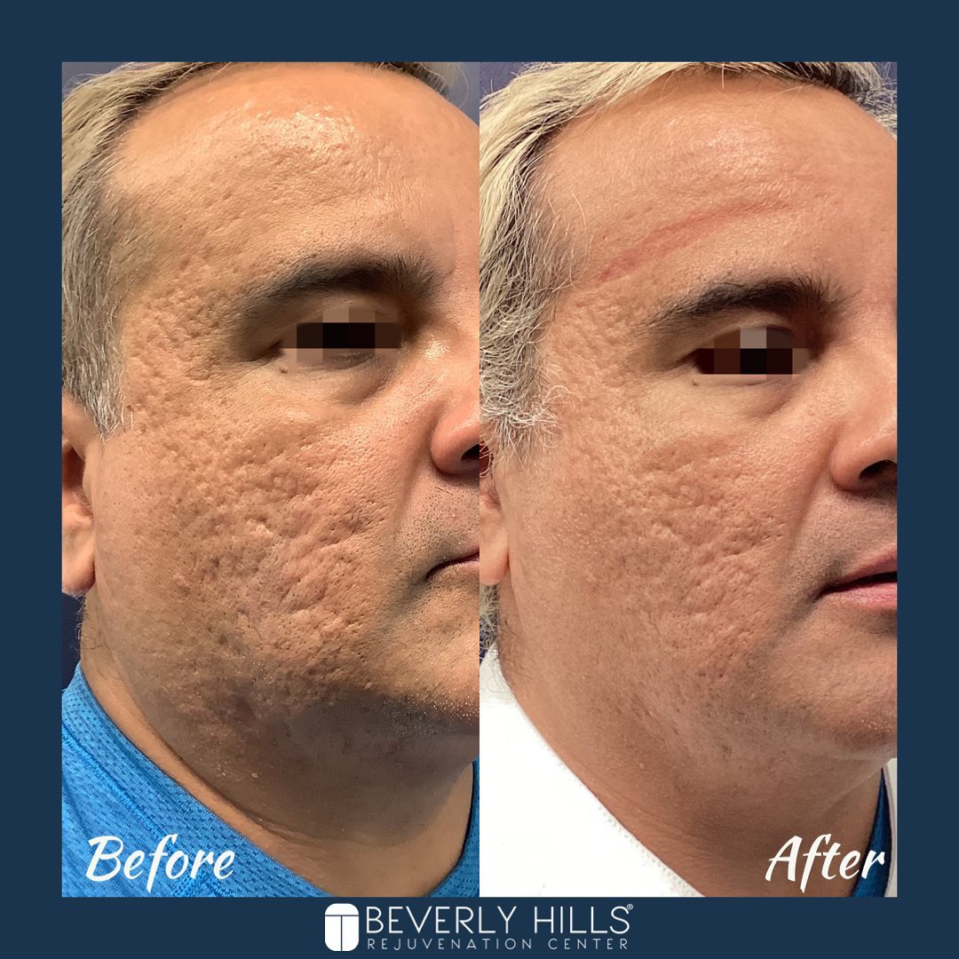 Beverly Hills Rejuvenation Center - Westlake Village & Valencia Facebook ad