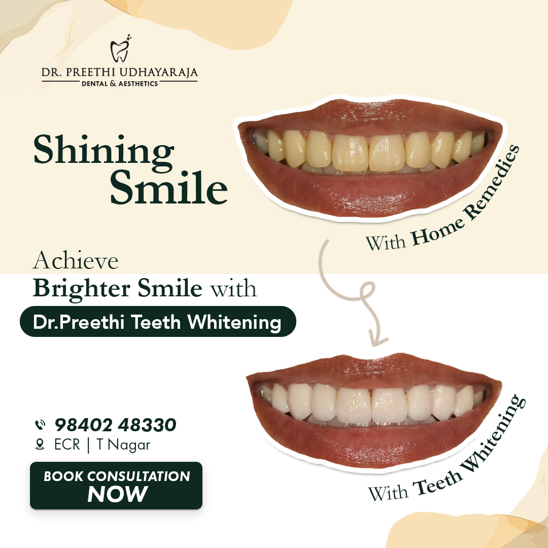 Dr.Preethi Udhayaraja Dental & Aesthetics Facebook ad: Smile Brighter & Feel Confident
