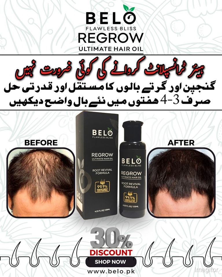 Belo.pk Facebook ad: اگر آپ گرتےہوئے بالوں سے پریشان اور گنج…