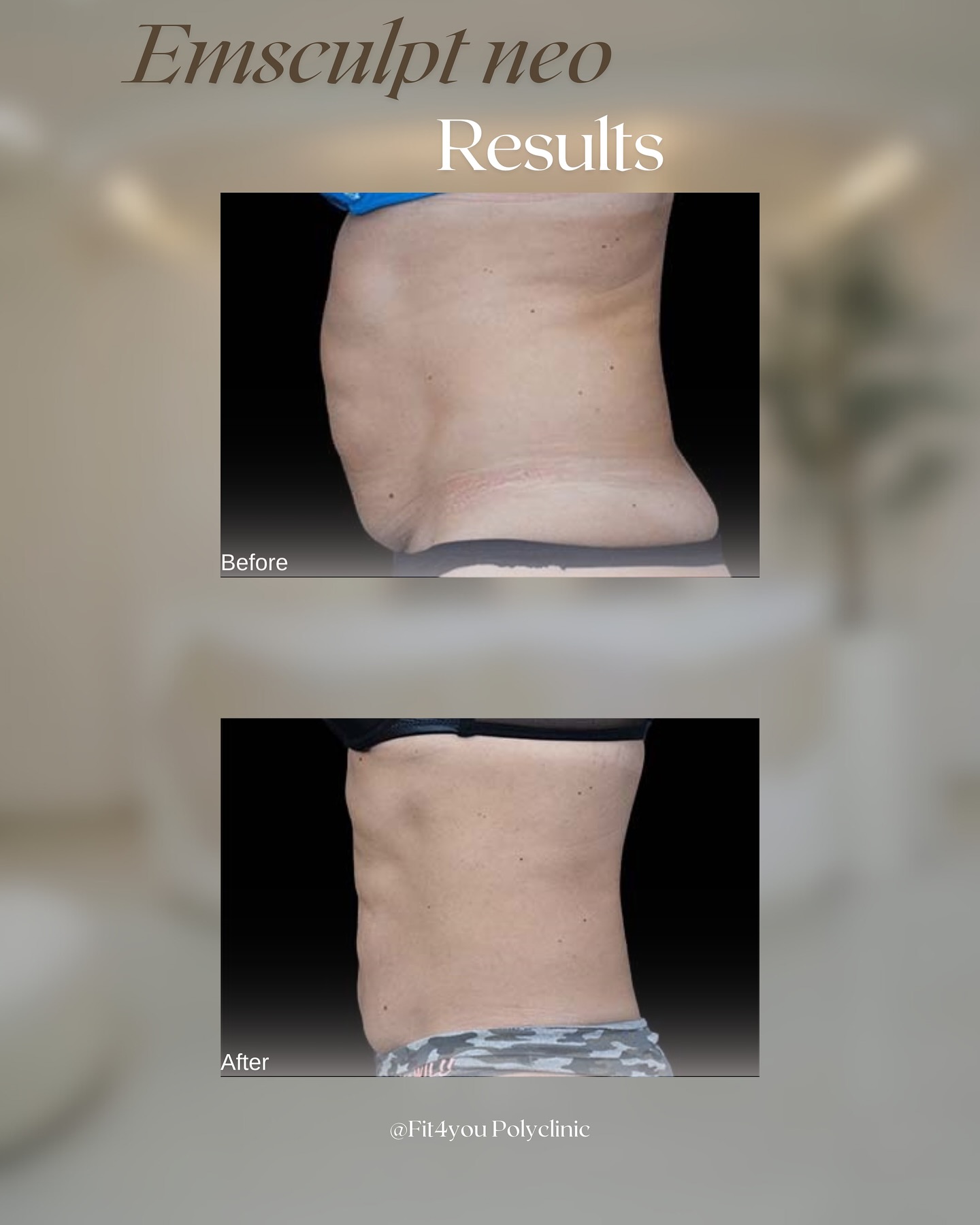 Fit4You Polyclinic Dubai Facebook ad: Transformation achieved! Witness the incredible results…