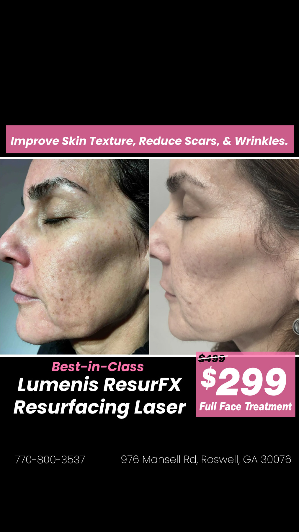 VC Esthetics MedSpa Facebook ad: $499 → Now $299