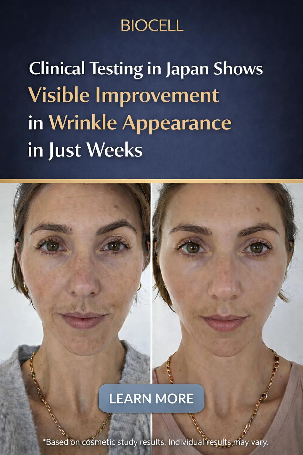 Veloura Facebook ad: Your skin isn’t aging… it’s missing this.