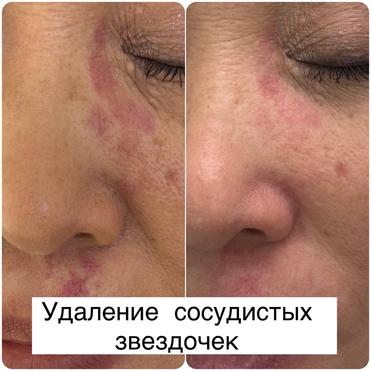 Genesis Tashkent Facebook ad: Результаты доктора